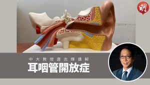 耳咽管開放症